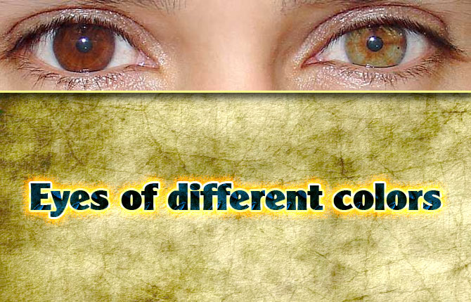 2-Eyes-of-different-colors