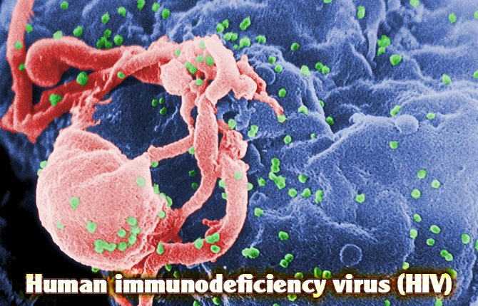 9-human-immunodeficiency-virus-hiv