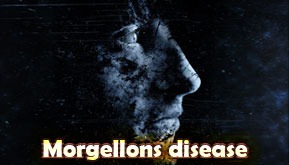 Morgellons disease