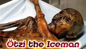 Ötzi the Iceman