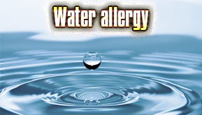 Water allergy