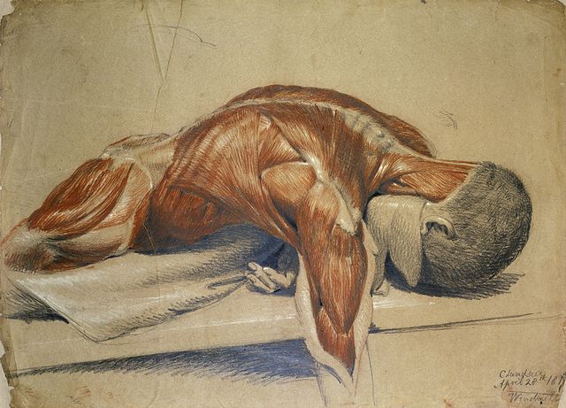 A painting of a dissected body, by Charles Landseer